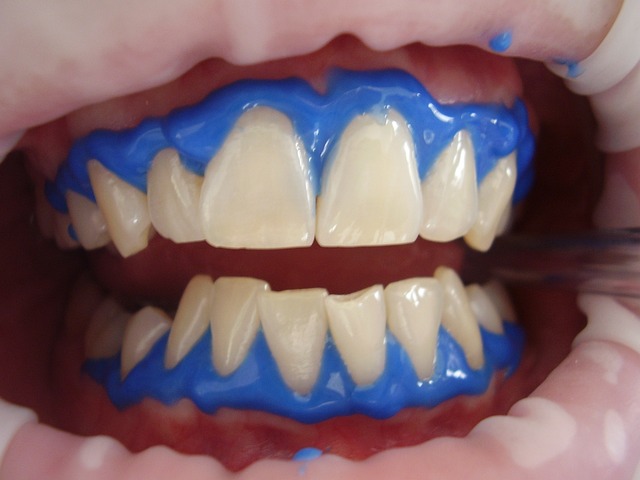 Cosmetic Dentistry